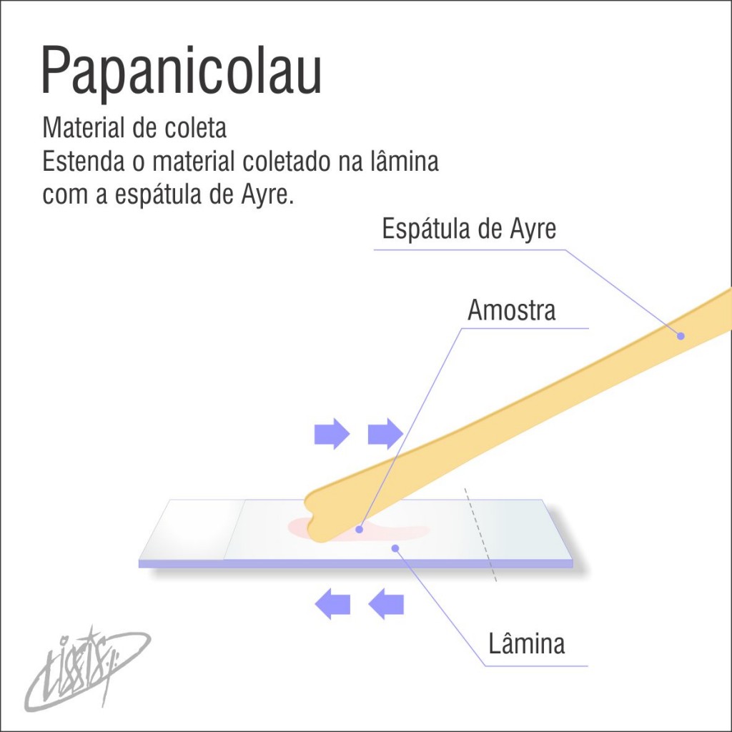 Papanicolau