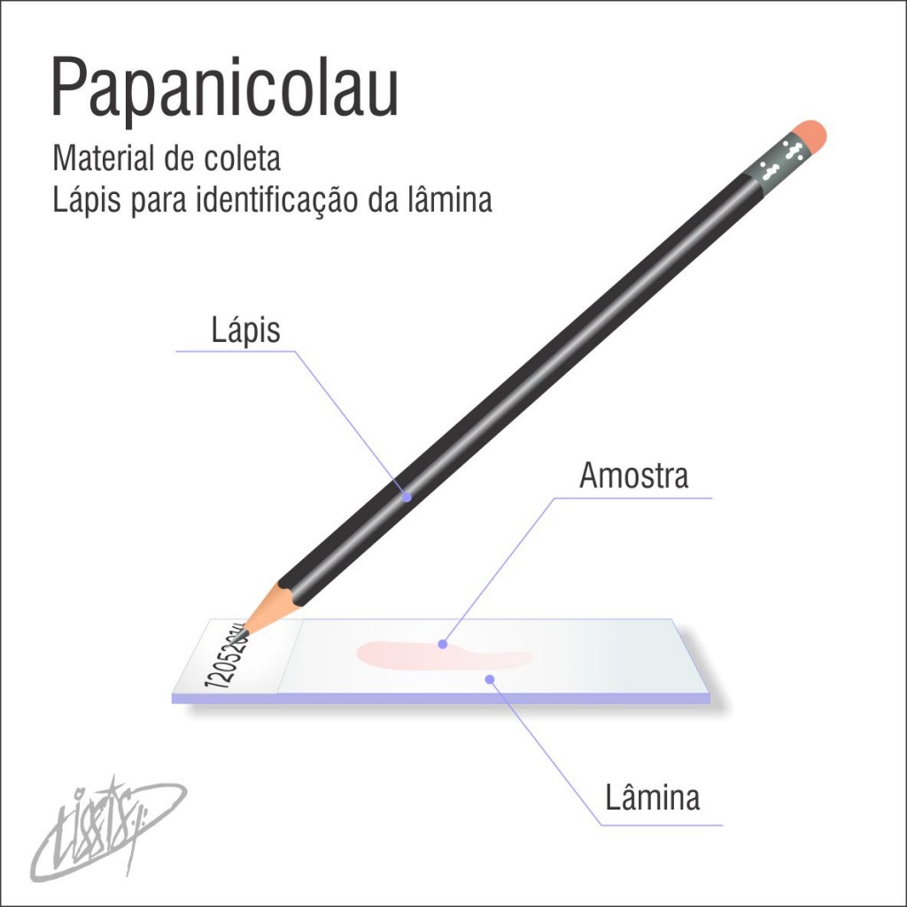 Papanicolau