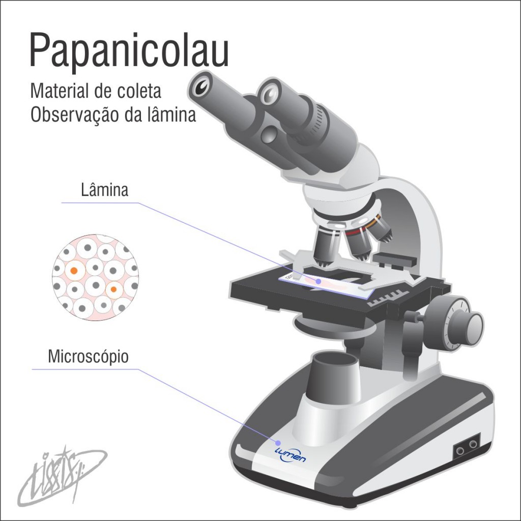 Papanicolau