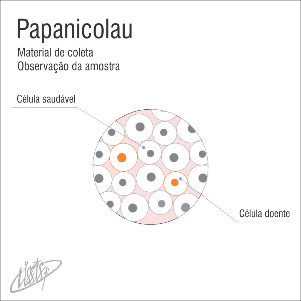 Papanicolau