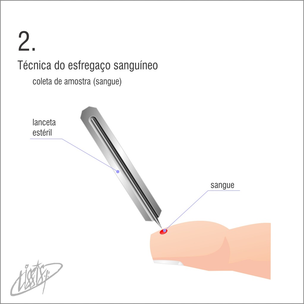 técnica de esfregaço 02