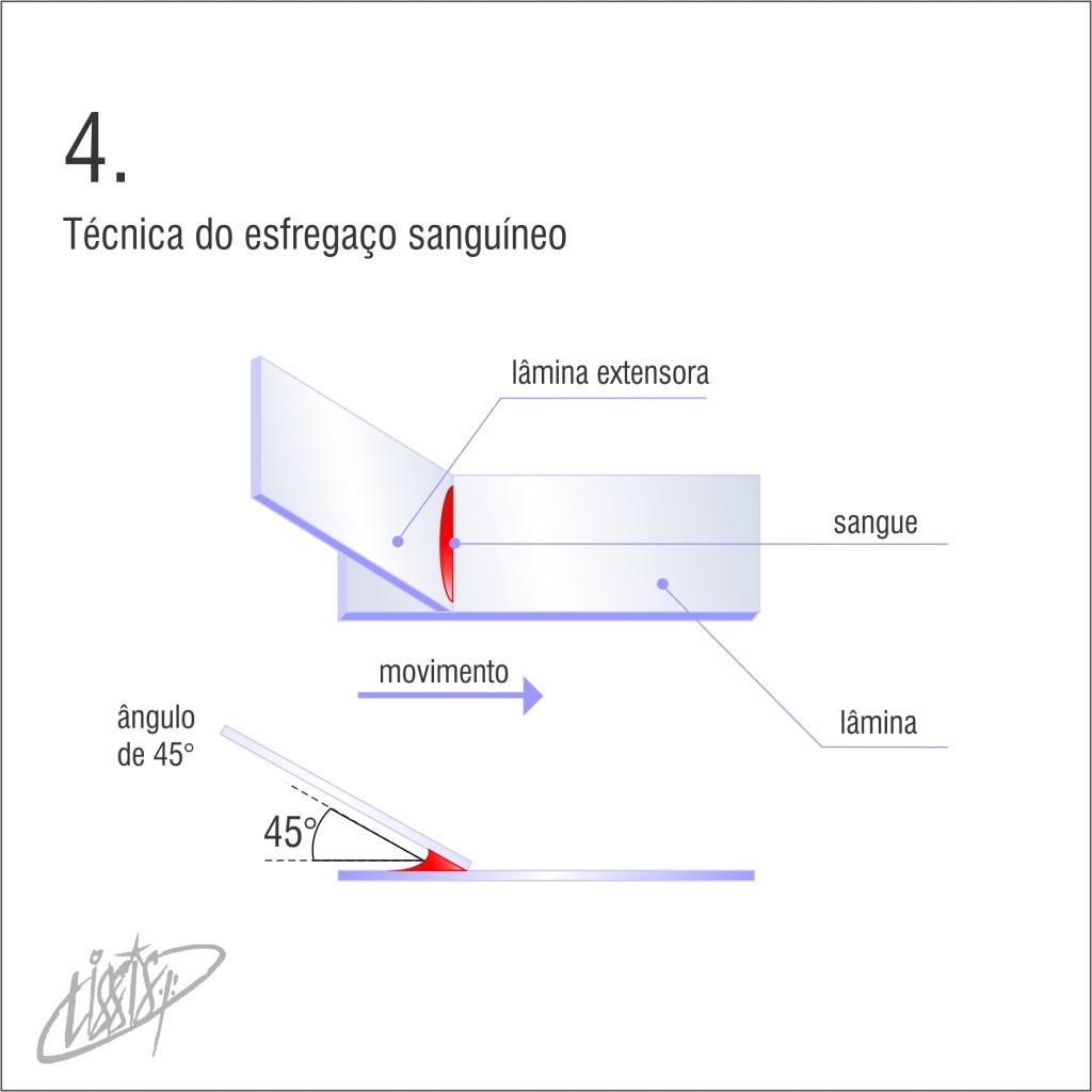 técnica de esfregaço 04