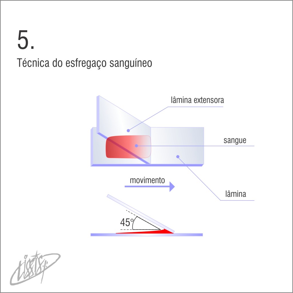 técnica de esfregaço 05