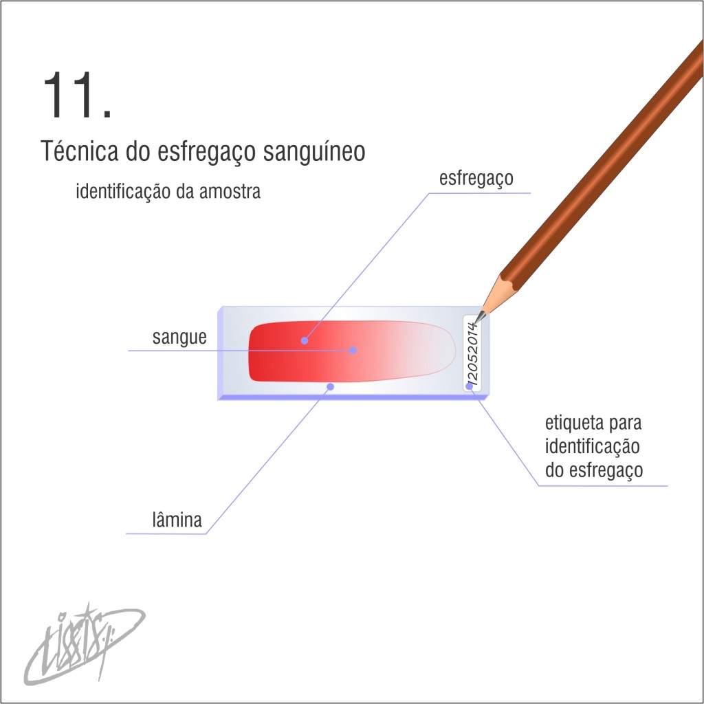 técnica de esfregaço 11